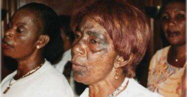 Bleaching creams